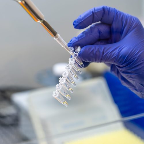 onderzoek naar vorm van gentherapie voor mensen met ziekte van Parkinson